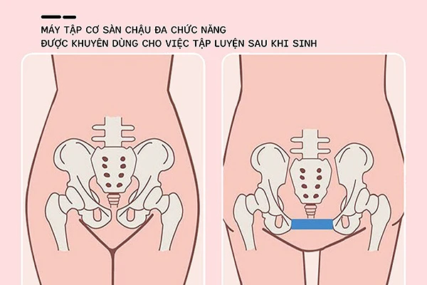 Giải đáp các câu hỏi thường gặp về Dụng cụ tập cơ sàn chậu